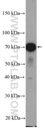 STAM Antibody in Western Blot (WB)