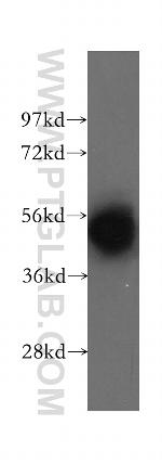 DBT Antibody in Western Blot (WB)