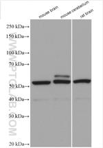 SEPT4 Antibody in Western Blot (WB)