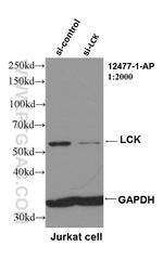 LCK Antibody in Western Blot (WB)