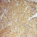 IRF2 Antibody in Immunohistochemistry (Paraffin) (IHC (P))