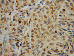 IRF2 Antibody in Immunohistochemistry (Paraffin) (IHC (P))