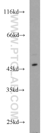 IRF2 Antibody in Western Blot (WB)