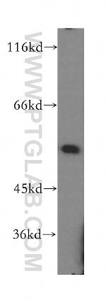 IRF2 Antibody in Western Blot (WB)