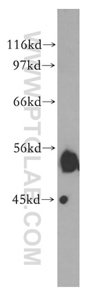 CPVL Antibody in Western Blot (WB)