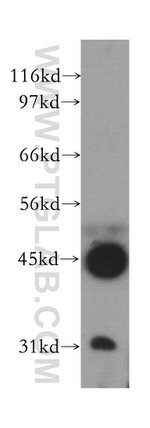 PRMT8 Antibody in Western Blot (WB)