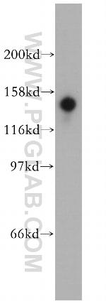 STK36 Antibody in Western Blot (WB)