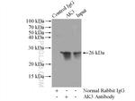 AK3 Antibody in Immunoprecipitation (IP)