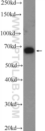 TRIM25 Antibody in Western Blot (WB)