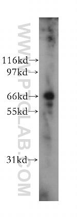 TRIM25 Antibody in Western Blot (WB)