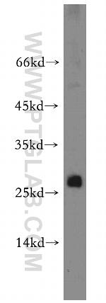 PTTG1IP Antibody in Western Blot (WB)