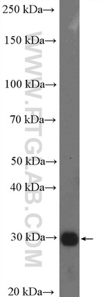 SULT4A1 Antibody in Western Blot (WB)