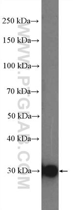 SULT4A1 Antibody in Western Blot (WB)