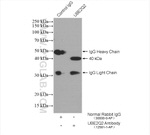 UBE2Q2 Antibody in Immunoprecipitation (IP)