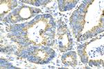 SUCLA2 Antibody in Immunohistochemistry (Paraffin) (IHC (P))