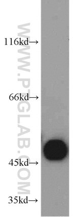 SUCLA2 Antibody in Western Blot (WB)