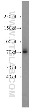 LAMP3 Antibody in Western Blot (WB)