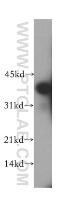 CIAPIN1 Antibody in Western Blot (WB)