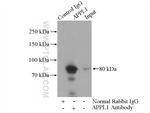 APPL1 Antibody in Immunoprecipitation (IP)