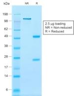 Calponin-1 Antibody in SDS-PAGE (SDS-PAGE)