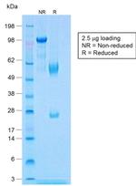 Calponin-1 Antibody in SDS-PAGE (SDS-PAGE)