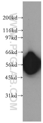 ENPP6 Antibody in Western Blot (WB)