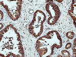 GlnRS Antibody in Immunohistochemistry (Paraffin) (IHC (P))