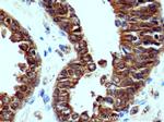 GlnRS Antibody in Immunohistochemistry (Paraffin) (IHC (P))