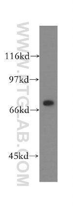 IMP5 Antibody in Western Blot (WB)