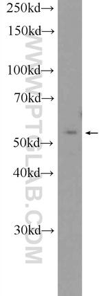 CaMKII gamma Antibody in Western Blot (WB)