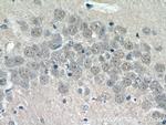 ZNF238 Antibody in Immunohistochemistry (Paraffin) (IHC (P))