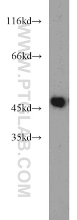 ZNF238 Antibody in Western Blot (WB)