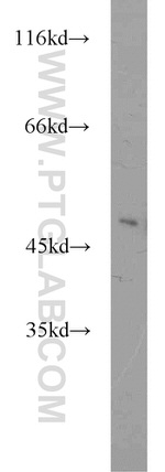 ZNF238 Antibody in Western Blot (WB)