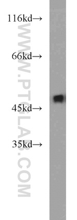 ZNF238 Antibody in Western Blot (WB)