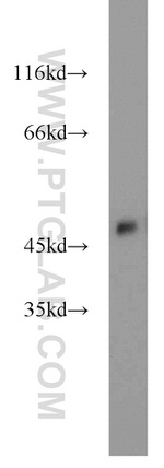 ZNF238 Antibody in Western Blot (WB)