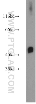 ZNF238 Antibody in Western Blot (WB)