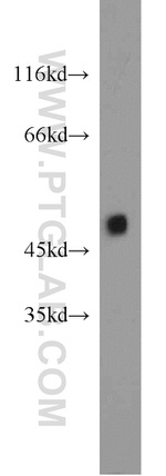 ZNF238 Antibody in Western Blot (WB)