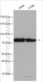 SLP76 Antibody in Western Blot (WB)