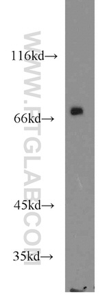 SLP76 Antibody in Western Blot (WB)