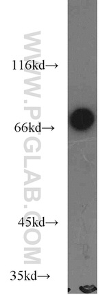 SLP76 Antibody in Western Blot (WB)