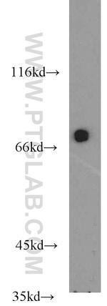 SLP76 Antibody in Western Blot (WB)