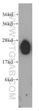 LIN7B Antibody in Western Blot (WB)