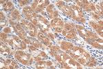 NET1 Antibody in Immunohistochemistry (Paraffin) (IHC (P))