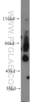 BBS4 Antibody in Western Blot (WB)