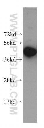 KRR1 Antibody in Western Blot (WB)