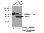 MAGEB4 Antibody in Immunoprecipitation (IP)