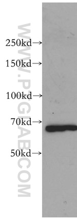 KGA/GAC Antibody in Western Blot (WB)