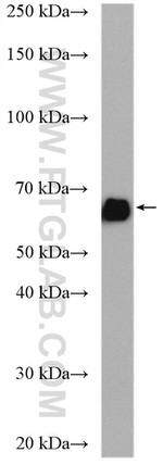 KGA/GAC Antibody in Western Blot (WB)