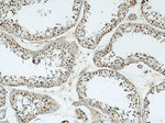 CUL4B Antibody in Immunohistochemistry (Paraffin) (IHC (P))