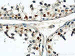 CUL4B Antibody in Immunohistochemistry (Paraffin) (IHC (P))